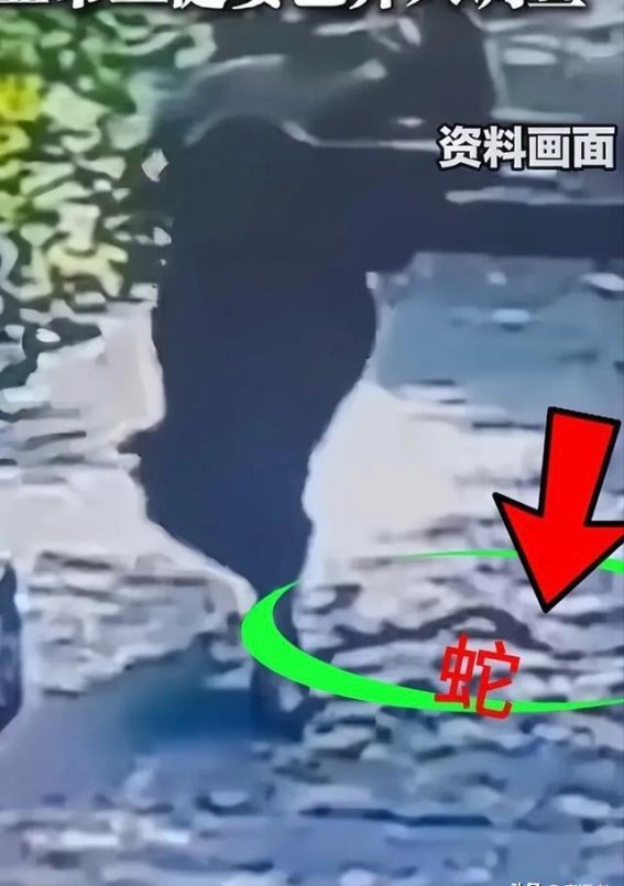 夺命三小时 三亚蛇伤女孩转院惊魂表弟哭诉就差一针血清