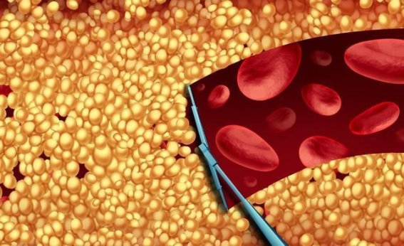 不吃鸡蛋和豆腐真的能显著降低血脂？专家解读