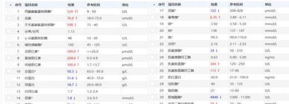 68岁大伯生吃海鲜感染戊型肝炎，重症治疗过程揭示食品安全隐患