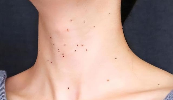 没有性生活就能避免宫颈癌吗？揭示真相与预防之道