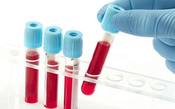 尿酸升高的警示信号：识别与应对