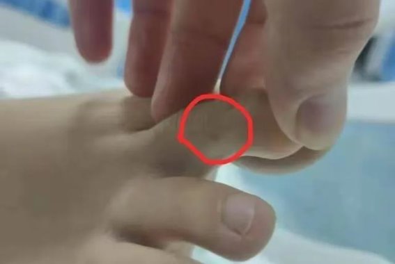 三亚女子疑遭不明生物咬伤身亡 医院救治陷入质疑风波