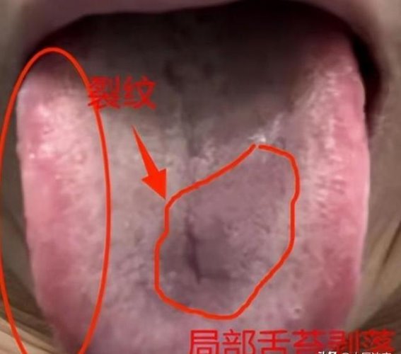 手脚冰凉，桂附地黄丸没效果？可能是肝出了问题