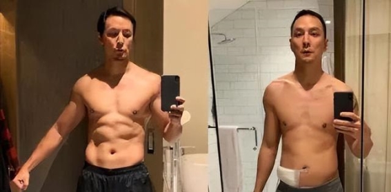 陈乔恩盲肠炎治疗经历引发关注，吴彦祖生死边缘的阑尾炎警示