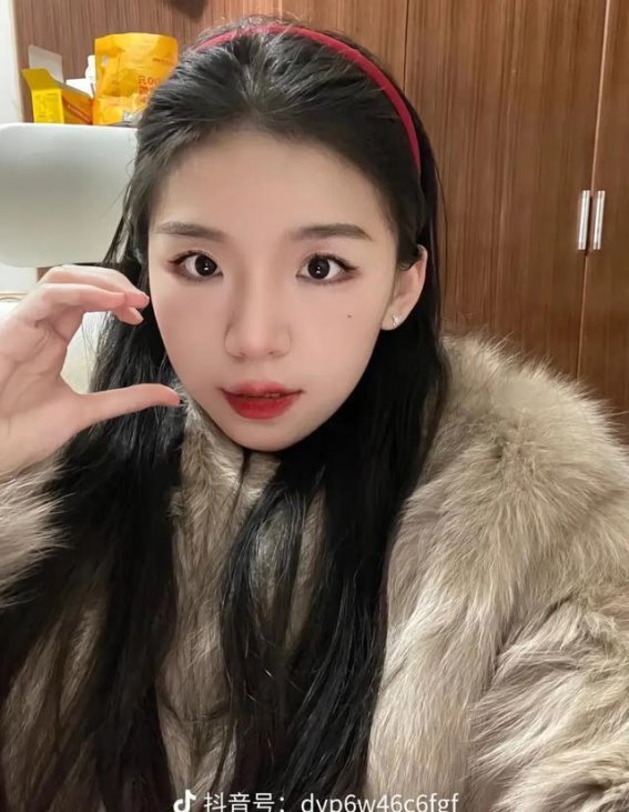 26岁网红小黄同学去世，警惕肺癌的早期症状，早期筛查至关重要