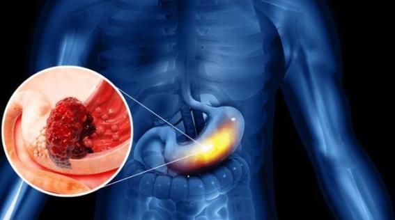 蕨菜的健康风险：享受美味还是埋下隐患？