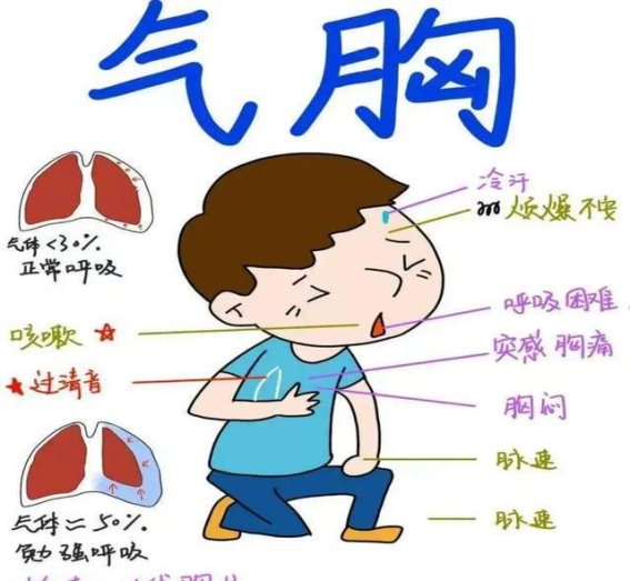 肺部漏气的症状、诊断与治疗全解析