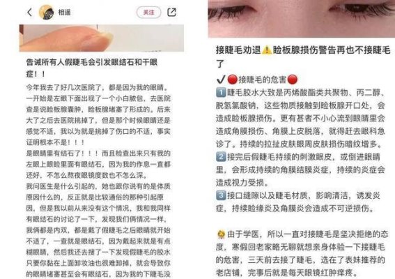磁吸假睫毛的流行与隐患