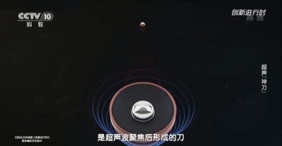 海扶刀：无创治疗肿瘤的创新技术