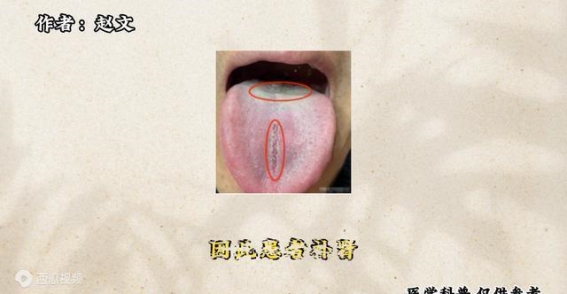 明明肾虚的厉害，却补肾无用，这种舌象病根在肝