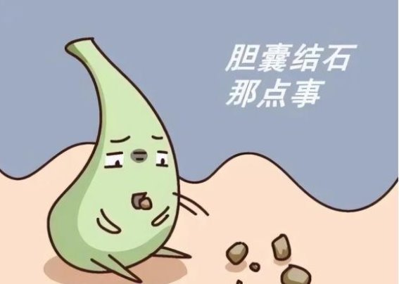 胆囊结石的家族遗传谜团：女性易罹患的真实原因