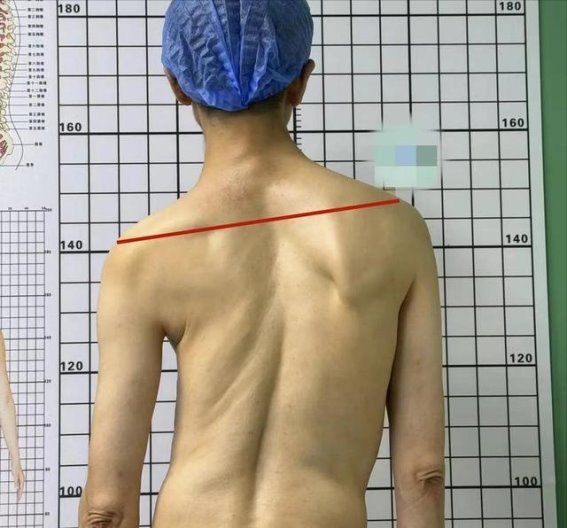 睡觉时选择左侧卧还是右侧卧？医生提醒：这3点你必须知道