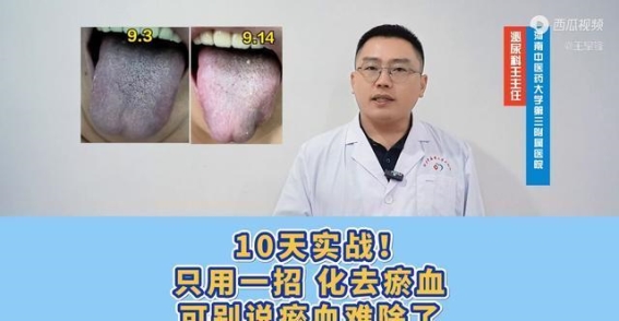十日实战：只用一招，轻松化解淤血难题