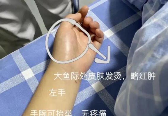 留置针并发症频发，护理不当恐酿大祸