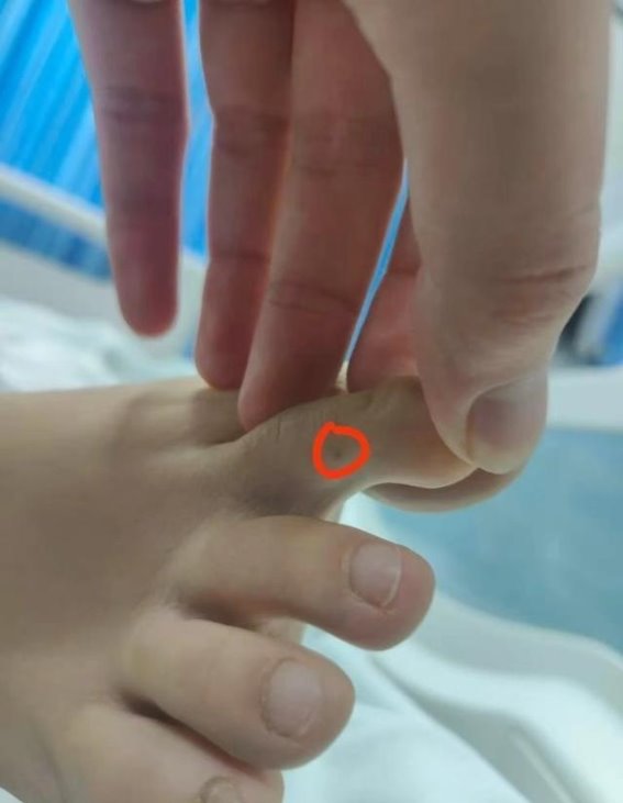 女子被不明生物咬伤身亡 警示夏季虫蛇伤害不可忽视